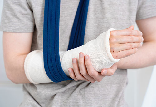 Close-up of arm in a cast and sling; legal representation for Grady County car or truck accidents.